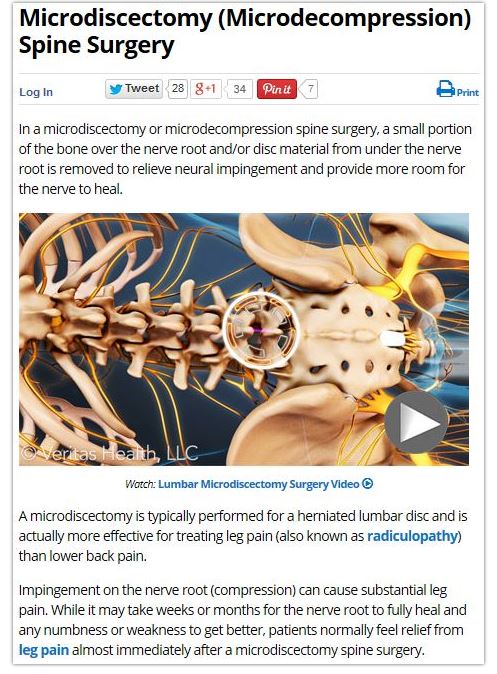 Motiejunas Back Surgery